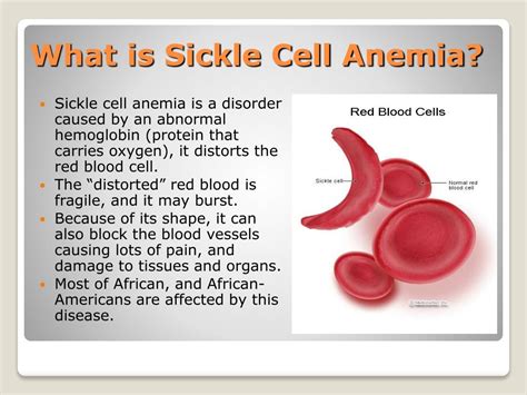 The Impact of Sickle Cell Anemia on Daily Life: 3 Ways it Changes Lives